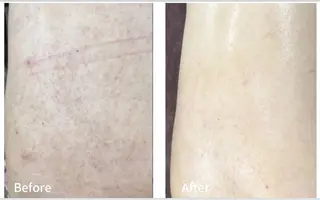 アンジェリック ビーナス　Rinonのエステ・リラクイメージ