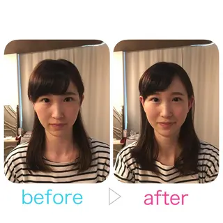 美容鍼とルート治療 iRu 金沢所属・中田 達也のその他イメージ