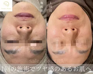 サロンドレナ名駅店所属・ハーブピーリング専門 サロンドレナ平岡のエステ・リラクイメージ