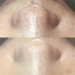 abbellina×UNO出雲塩冶店《ウノ》所属・フェイシャルエステ 🫧琉衣のエステ・リラクイメージ