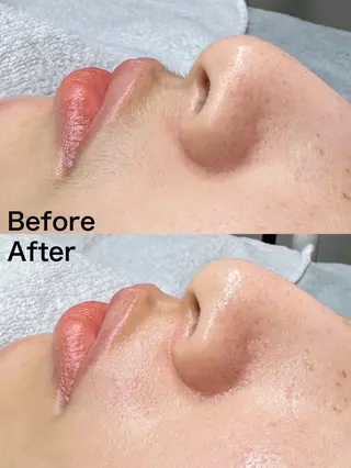 マツヤニワックス専門 堂山町 ルミエールのエステ・リラクイメージ