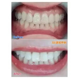 M渋谷店所属・Ｍ渋谷 ホワイトニングのエステ・リラクイメージ