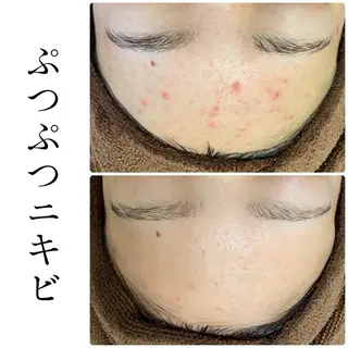 ハーブピーリング専門 BIOEL横浜のエステ・リラクイメージ