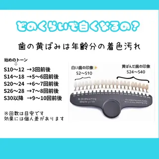 ホワイトニング ショップ多摩店のその他イメージ