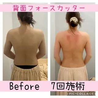 ブライダル痩身×脱毛 尼崎駅前サロンのエステ・リラクイメージ