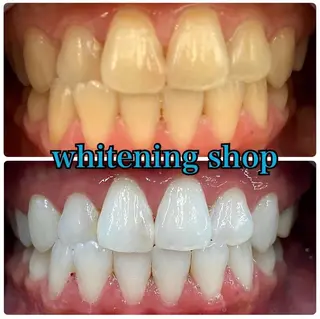 ホワイトニング ショップ吉祥寺店のエステ・リラクイメージ