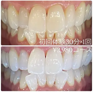 PLATINUM Beauty 横浜店所属・ホワイトニングルーム 横浜店のその他イメージ