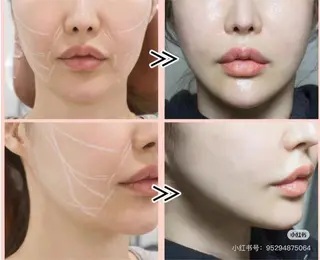 ネイル aliaハイフ&水光ジェットサロン所属・aliaハーブ水光店 エステティシャン募集のエステ・リラクイメージ