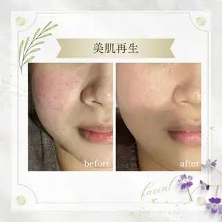 《 肌質×美肌 》 addissimoのエステ・リラクイメージ