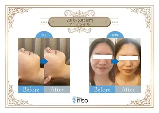 毛穴/肌質改善サロン クレアベレッツァのエステ・リラクイメージ