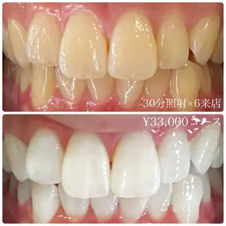 PLATINUM Beauty 横浜店所属・ホワイトニングルーム 横浜店のその他イメージ