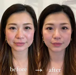 美容鍼・鍼灸専門❤✨ 近藤めぐみのエステ・リラクイメージ