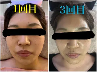 アロマ･美容鍼･カッ ピング「麗」鍼灸院のエステ・リラクイメージ