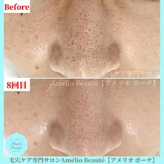 毛穴ケア専門サロン Amélio Beauté所属・毛穴ケア専門サロン アメリオボーテのその他イメージ