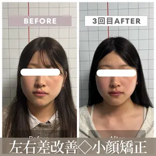 【小顔リフト×小顔矯正専門店】RED所属・猿渡 ひかるのエステ・リラクイメージ