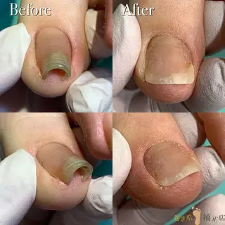 ネイル 東京巻き爪アカデミー所属・東京巻き爪 アカデミーのエステ・リラクイメージ