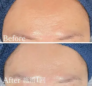 アンド ミルルのエステ・リラクイメージ