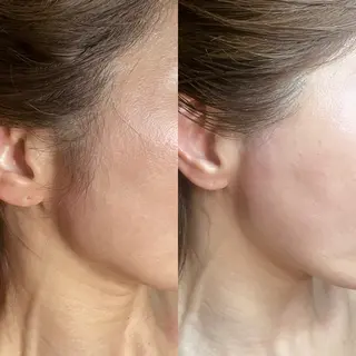 GOLDEN AGE所属・GOLDEN AGEのエステ・リラクイメージ