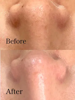 肌質改善専門サロン Bellmi/心斎橋のエステ・リラクイメージ