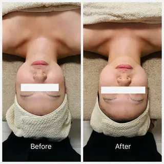 リンパマッサージ&小顔コルギ　More bliss所属・More blissのエステ・リラクイメージ