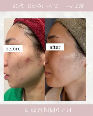 ARuru所属・ARuru 本店のエステ・リラクイメージ