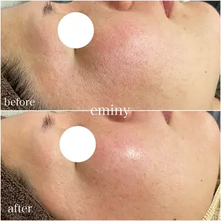 eminy まみのエステ・リラクイメージ