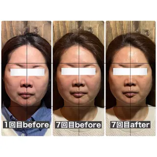 💎後悔させない小顔 矯正💎イトヤマ🌱のエステ・リラクイメージ