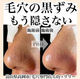 リリー yuriのエステ・リラクイメージ