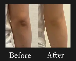 よもぎ蒸し専門店Artemisia所属・よもぎ蒸し専門店 Artemisiaのエステ・リラクイメージ