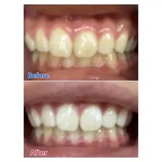 M渋谷店所属・M渋谷 ホワイトニングのエステ・リラクイメージ