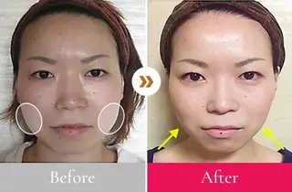 小顔整体研究所 KSラボ川崎店内田のエステ・リラクイメージ