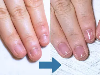 ネイル 深爪矯正・自爪育成 ネイルサロンアモまいのネイルデザイン