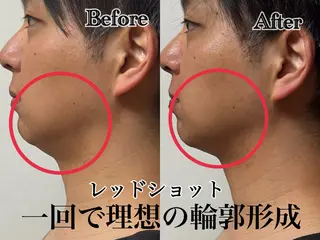 六本木脱毛andS 店長Sachiのエステ・リラクイメージ