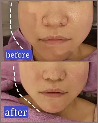 🅖🅤🅩🅔🅛 salonのエステ・リラクイメージ