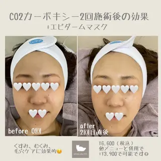 1ヶ月後も半分残る 高持続LEDエクステのマツエク・マツパデザイン