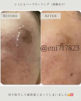 シミ毛穴|眉Wax THE  flowのエステ・リラクイメージ