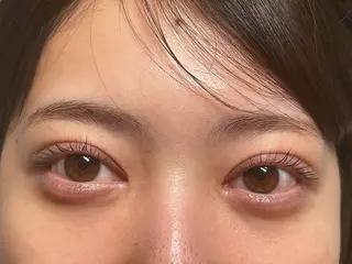 マツエク・マツパ NaKid マツエク&マツパのマツエク・マツパデザイン