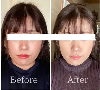 丸顔さんの救世主 高田 くみのエステ・リラクイメージ