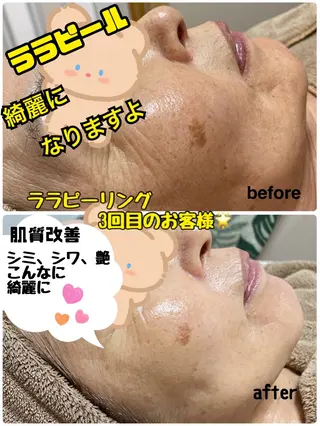 山崎 陽子のエステ・リラクイメージ