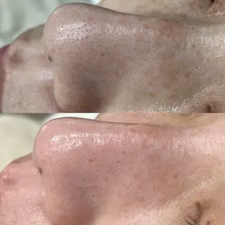 毛穴に特化したサロン MYFAIRLADYのエステ・リラクイメージ