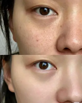 ネイル aliaハイフ&水光ジェットサロン所属・aliaハーブ水光店 エステティシャン募集のエステ・リラクイメージ