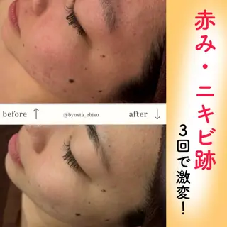 🎀葛野 日向子🎀のエステ・リラクイメージ