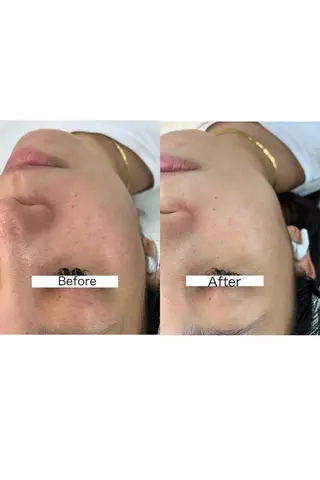 ナリスビューティサロンあべの所属・肌質改善/ツヤ肌作り /松本杏奈のエステ・リラクイメージ