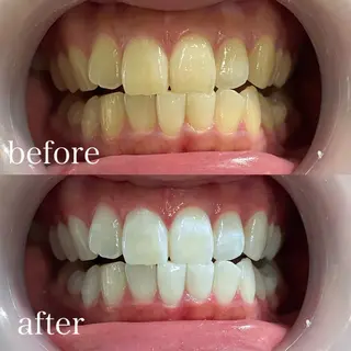 ホワイトニング×肌質 改善~elエル~のその他イメージ