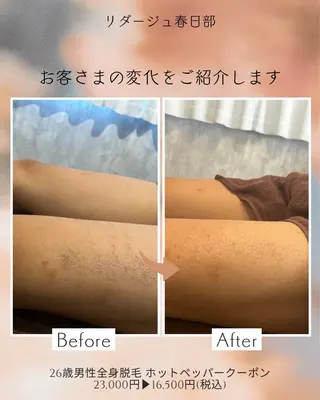 春日部 リダージュのエステ・リラクイメージ