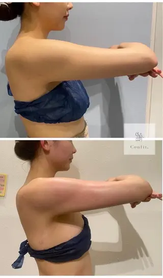 小顔/たるみ/黒ずみ除去専門サロン/SONA 大和西大寺店所属・【小顔痩身専門看護師 サロンSONA】のエステ・リラクイメージ