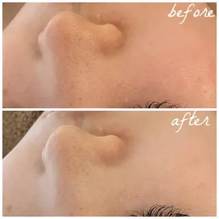 メンズ メナード岐阜市茜部 杉浦のエステ・リラクイメージ