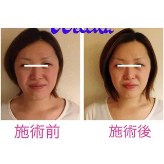 痩身・小顔・骨盤矯正×ヒップアップ専門エステ Peach所属・桃尻つかさ🍑小顔× ノーファンデ肌作りのエステ・リラクイメージ