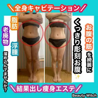 痩身/脱毛/ネイル HARUKAのエステ・リラクイメージ