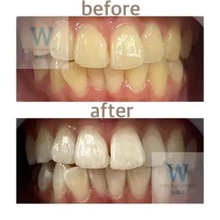 ホワイトニング ショップ船橋店🦷のエステ・リラクイメージ